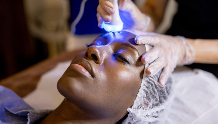 Microdermabrasion Treatment